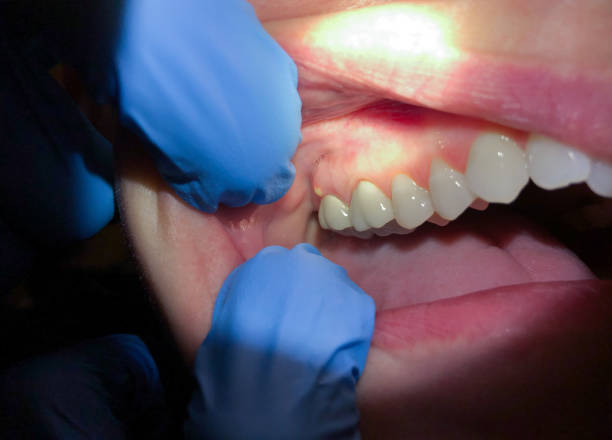 Best Emergency Cosmetic Dentistry in Hideaway, TX