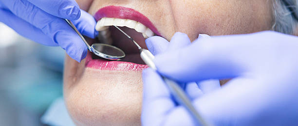 Best Emergency Dental Extractions in Hideaway, TX