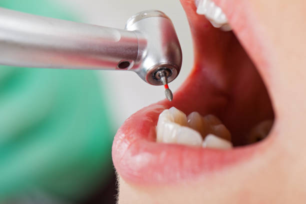 Best Emergency Dental Services for Seniors in Hideaway, TX